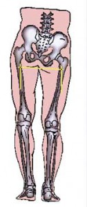 leg-length-deficiency